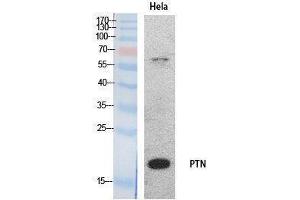 Western Blotting (WB) image for anti-Pleiotrophin (PTN) (Internal Region) antibody (ABIN3181062) (Pleiotrophin antibody  (Internal Region))