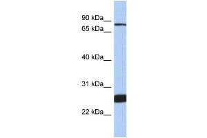 WB Suggested Anti-NFE2L1 Antibody Titration: 1.