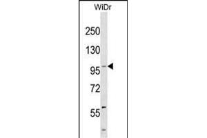 KIT Antibody (Center ) western blot analysis in WiDr cell line lysates (35 μg/lane). (KIT antibody  (AA 708-737))