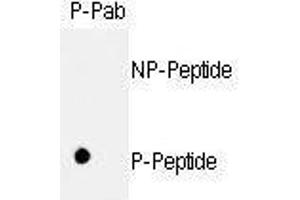 Dot blot analysis of anti-hRb- Phospho-specific Pab (ABIN389648 and ABIN2839638) on nitrocellulose membrane. (Retinoblastoma 1 antibody  (pSer811))