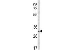Western Blotting (WB) image for anti-NAD(P)H Dehydrogenase, Quinone 1 (NQO1) (AA 118-144) antibody (ABIN3031928)