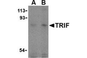 Western blot analysis of TRIF in human lung cell lysates with this product at (A) 2 and (B) 4 μg/ml. (TICAM1 antibody  (C-Term))