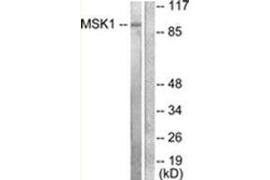 Western blot analysis of extracts from 293 cells, treated with UV 15', using MSK1 Antibody .