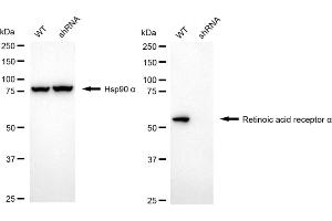 Western blotting analysis using Retinoic Acid Receptor alpha antibody (ABIN7800189).
