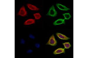 ABIN7094466 and ABIN7098514 staining HepG2 cells by IF/ICC. (SCG2 antibody  (N-Term))