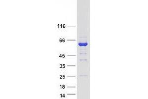 Validation with Western Blot (FSD1 Protein (Myc-DYKDDDDK Tag))