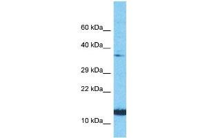 Host:  Rabbit  Target Name:  NINJ1  Sample Type:  PANC1 Whole Cell lysates  Antibody Dilution:  1.