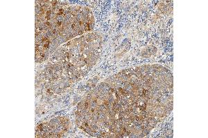 IHC analysis of SNPH using anti-SNPH antibody (ABIN7601724). (Syntaphilin antibody  (AA 43-482))