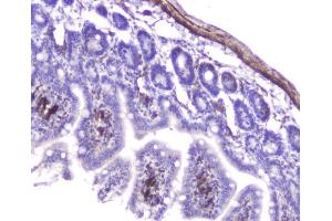 IHC analysis of Hsp27 using anti-Hsp27 antibody (ABIN6719322). (HSP27 antibody  (AA 1-209))