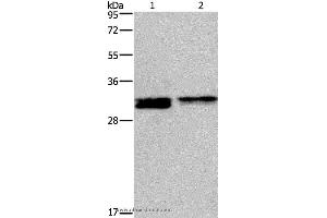 Western blot analysis of Hela and Jurkat cell, using FOSL1 Polyclonal Antibody at dilution of 1:615 (FOSL1 antibody)