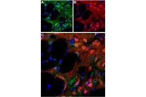 Expression of D5 dopamine receptor in rat striatumImmunohistochemical staining of perfusion-fixed rat brain frozen using Anti-D5 Dopamine Receptor (extracellular) Antibody (ABIN7043111, ABIN7044234 and ABIN7044235), (1:100). (Dopamine Receptor D5 (DRD5) Peptide)
