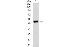 Western Blotting (WB) image for anti-ATP Citrate Lyase (ACLY) (AA 306-502) antibody (ABIN1842880) (ACLY antibody  (AA 306-502))