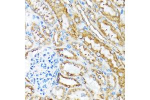 Immunohistochemistry of paraffin-embedded mouse kidney using MSP/MST1 Rabbit mAb (ABIN1680891, ABIN1680890, ABIN3015057 and ABIN3015058) at dilution of 1:100 (40x lens). (MST1 antibody)