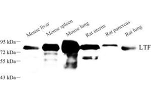 Western blot analysis of LTF (ABIN7074457) at dilution of 1: 1000 (Lactoferrin antibody)