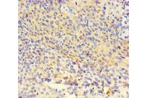Immunohistochemistry of paraffin-embedded human thyroid tissue using ABIN7162411 at dilution of 1:100 (NR1H3 antibody  (AA 1-402))