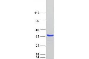 Western Blotting (WB) image for Multivesicular Body Subunit 12B (MVB12B) (Transcript Variant 2) protein (Myc-DYKDDDDK Tag) (ABIN2720746)