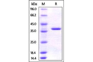 Human AIMP1, His Tag on SDS-PAGE under reducing (R) condition. (AIMP1 Protein (AA 2-312) (His tag))
