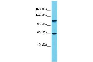 Host: Rabbit  Target Name: Mprip  Sample Tissue: Rat Stomach lysates  Antibody Dilution: 1. (MPRIP antibody  (Middle Region))