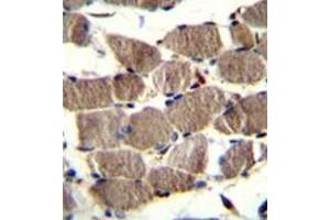 Immunohistochemistry analysis in formalin fixed and paraffin embedded human skeletal muscle reacted withPION / GSAP (C-term) Antibody (C-term) followed by peroxidase conjugation of the secondary antibody and DAB staining. (GSAP antibody  (C-Term))