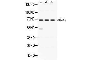 Western blot analysis of ABCE1 expression in rat spleen extract ( Lane 1), mouse thymus extract ( Lane 2) and HELA whole cell lysates ( Lane 3). (ABCE1 antibody  (AA 419-599))