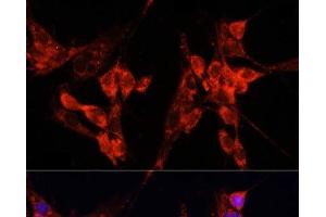 Immunofluorescence analysis of NIH-3T3 cells using ETF1 Polyclonal Antibody at dilution of 1:100 (40x lens). (ETF1 antibody)