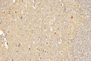 Immunohistochemistry (Paraffin-embedded Sections) (IHC (p)) image for anti-Growth Differentiation Factor 6 (GDF6) antibody (ABIN7074132)