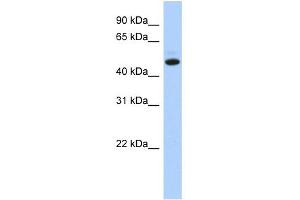 WB Suggested Anti-C5orf36 Antibody Titration: 0. (C5orf36 antibody  (N-Term))