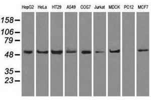 Image no. 6 for anti-ATP Synthase, H+ Transporting, Mitochondrial F1 Complex, beta Polypeptide (ATP5B) antibody (ABIN1496769) (ATP5B antibody)
