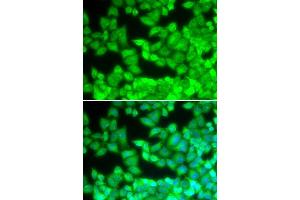 Immunofluorescence analysis of U20S cell using CD40LG antibody. (CD40 Ligand antibody  (AA 47-223))