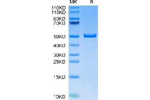 Human ILDR2 on Tris-Bis PAGE under reduced condition. (ILDR2 Protein (AA 21-184) (Fc Tag))