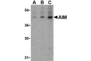 Western Blotting (WB) image for anti-CD5 Molecule-Like (CD5L) (N-Term) antibody (ABIN2472166) (CD5L antibody  (N-Term))