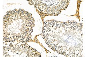 anti-Frizzled Family Receptor 3 (FZD3) (Internal Region) antibody