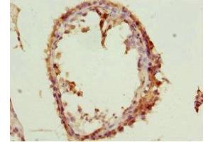 Immunohistochemistry of paraffin-embedded human testis tissue using ABIN7170599 at dilution of 1:100 (Spindlin 1 antibody  (AA 1-262))