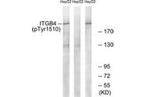 Western blot analysis of extracts from HepG2 cells treated with Na2VO3 0. (Integrin beta 4 antibody  (pTyr1510))