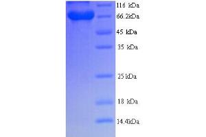 SDS-PAGE (SDS) image for BRCA1 Associated Protein (BRAP) (AA 1-592), (full length) protein (His tag) (ABIN5714412) (BRAP Protein (AA 1-592, full length) (His tag))