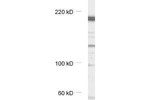 dilution: 1 : 1000, sample: synaptic membrane fraction of rat brain (LP1) (CASKIN1 antibody)