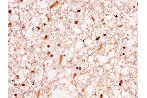 IHC image of ABIN7155098 diluted at 1:300 and staining in paraffin-embedded human brain tissue performed on a Leica BondTM system. (HNRNPA1 antibody  (AA 2-354))