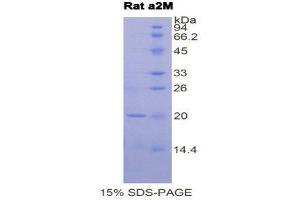 SDS-PAGE (SDS) image for alpha-2-Macroglobulin (A2M) (AA 574-734) protein (His tag) (ABIN1878523)