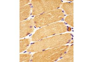 Antibody staining DVL1 in human skeletal muscle sections by Immunohistochemistry (IHC-P - paraformaldehyde-fixed, paraffin-embedded sections). (DVL1 antibody  (AA 442-470))
