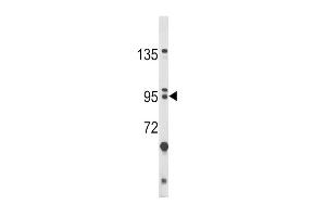 Western blot analysis of BICC1 Antibody (N-term) (ABIN390954 and ABIN2841144) in HL-60 cell line lysates (35 μg/lane). (BICC1 antibody  (N-Term))