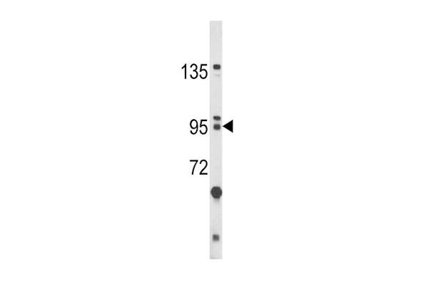 BICC1 antibody  (N-Term)