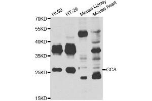 Western blot analysis of extracts of various cell lines, using GCA antibody. (Grancalcin antibody)