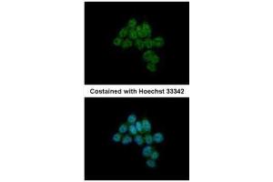 ICC/IF Image Immunofluorescence analysis of paraformaldehyde-fixed HCT116, using CREB3L1, antibody at 1:500 dilution. (CREB3L1 antibody  (C-Term))