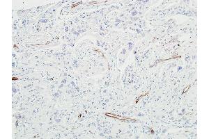 Immunohistochemistry (IHC) image for anti-Cadherin 5 (CDH5) (AA 48-599) antibody (ABIN7455190) (Recombinant Cadherin 5 antibody  (AA 48-599))