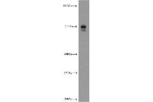 Western Blotting (WB) image for anti-Hepatic and Glial Cell Adhesion Molecule (HEPACAM) antibody (ABIN2932707) (HEPACAM antibody)