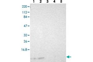 Western blot analysis of Lane 1: RT-4, Lane 2: U-251 MG, Lane 3: Human Plasma, Lane 4: Liver, Lane 5: Tonsil with RPS21 polyclonal antibody  at 1:250-1:500 dilution.