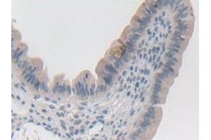 Immunohistochemistry (IHC) image for anti-Synapsin I (SYN1) (AA 113-420) antibody (ABIN7440944)