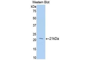 Western blot analysis of the recombinant protein. (MGEA5 antibody  (AA 271-438))