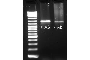 EndpointPCR with and without HotStart Antibody (Taq DNA Polymerase antibody)