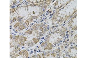 Immunohistochemistry of paraffin-embedded Human stomach using VIP Polyclonal Antibody (Vip antibody)